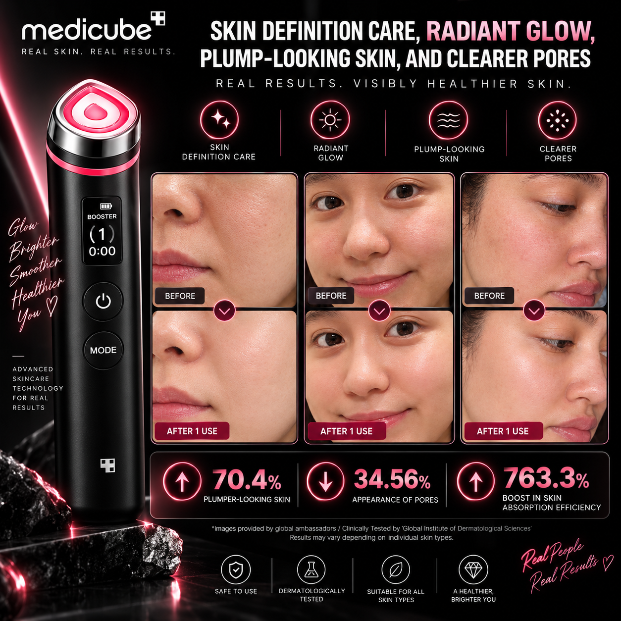 Medicube AGE-R Booster Pro Roller ✨